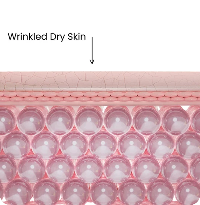 Wrinkled, dry skin