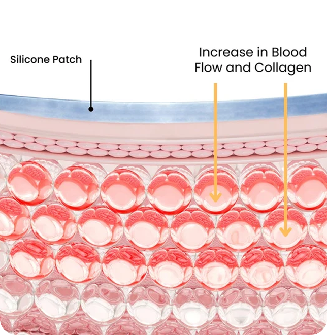 Increases blood flow &amp; collagen