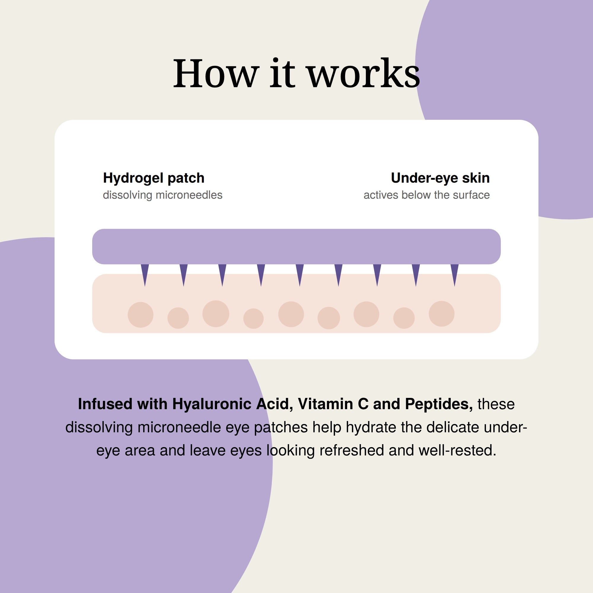 Diagram showing the hydrogel patch and its dissolving microneedles releasing actives below the surface of the under-eye skin.