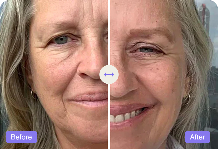Brigitte, 57