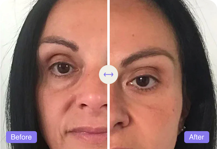 Zafira, 50